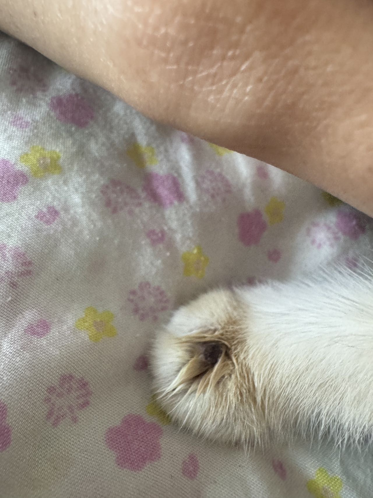 症状描述图片
