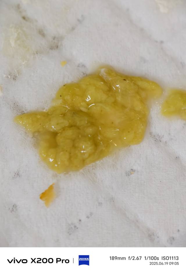 症状描述图片